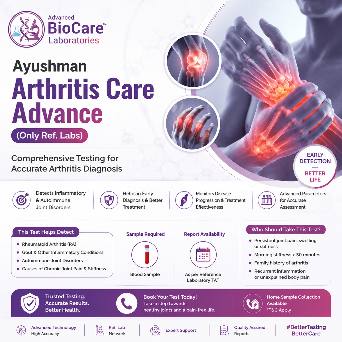 Ayushman Arthritis Care Advance (only Ref. Labs)