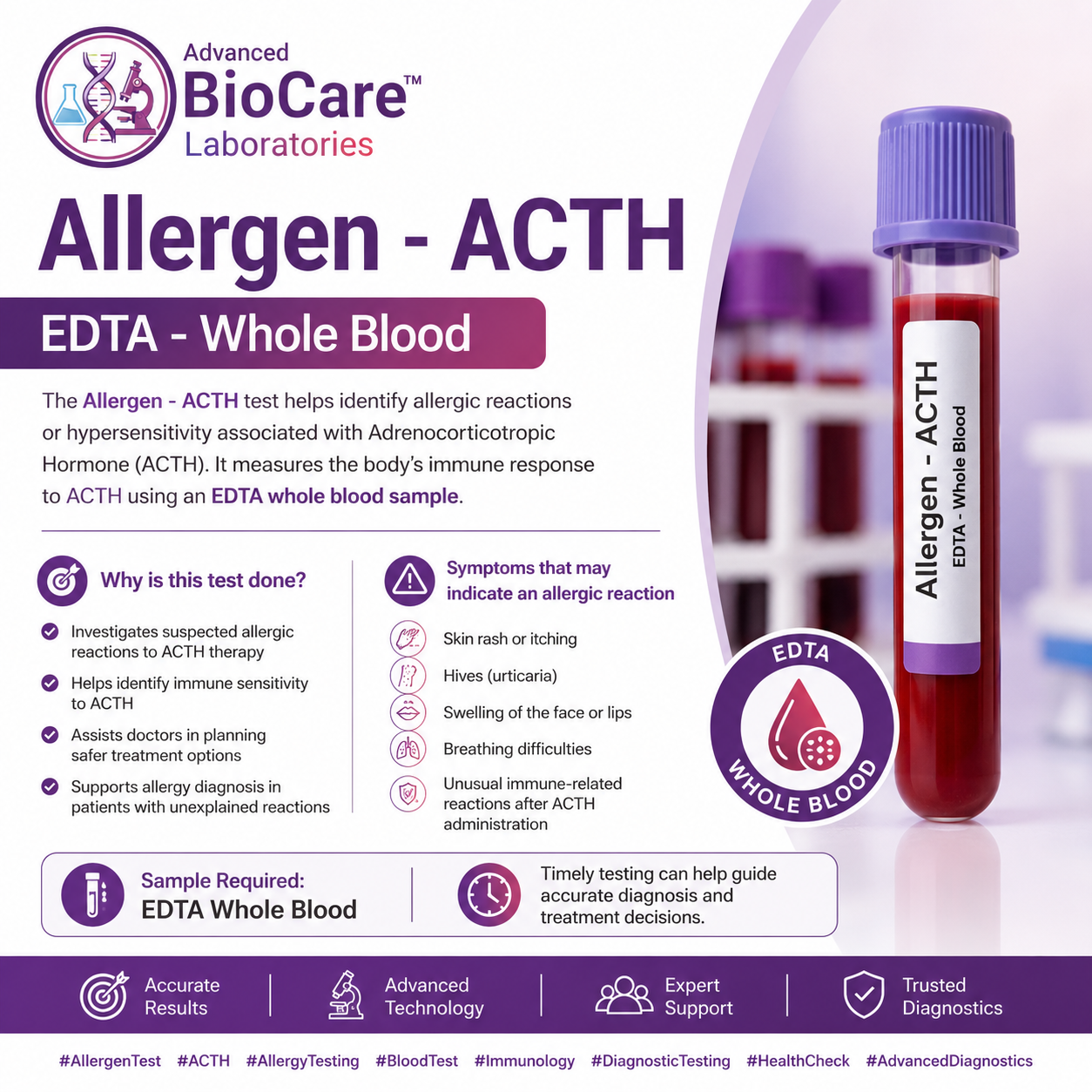 Allergen - ACTH, EDTA-Whole Blood