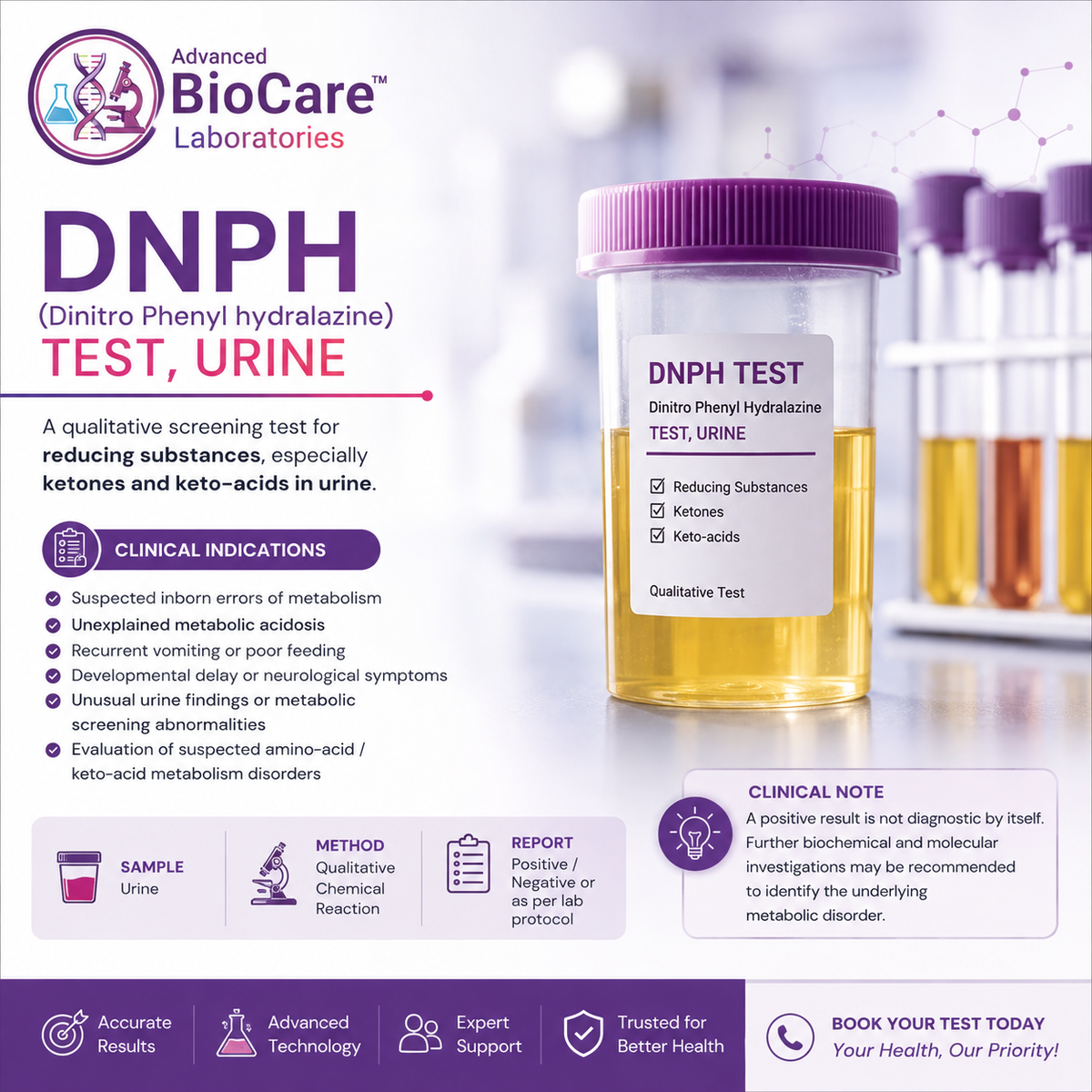 DNPH (Dinitro Phenyl hydralazine) test, urine