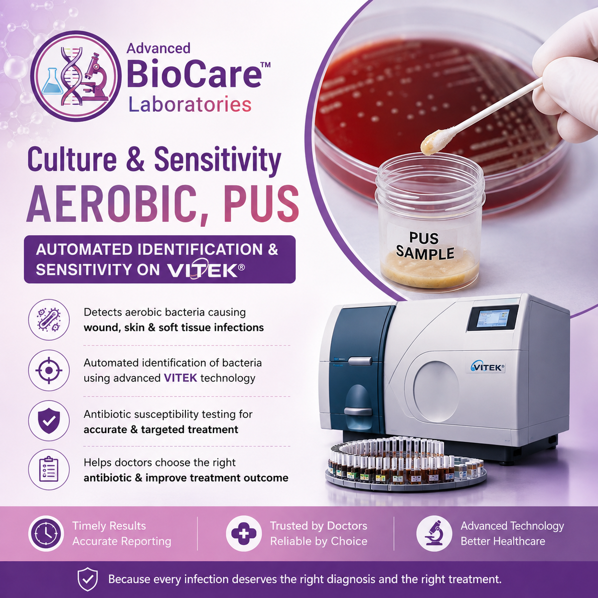 Culture & Sensitivity, Aerobic, Pus- Automated Identification & Sensitivity on Vitek