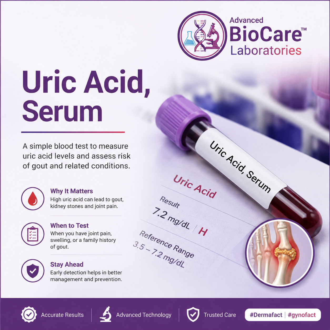 Uric Acid, Serum