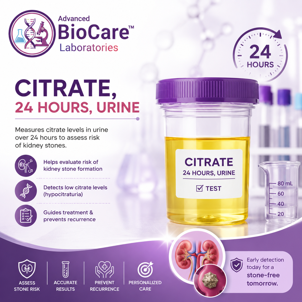 Citrate, 24 hours,  Urine