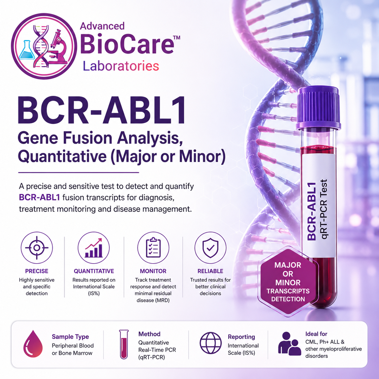 BCR-ABL1  gene fusion analysis,quantitative (Major or Minor)
