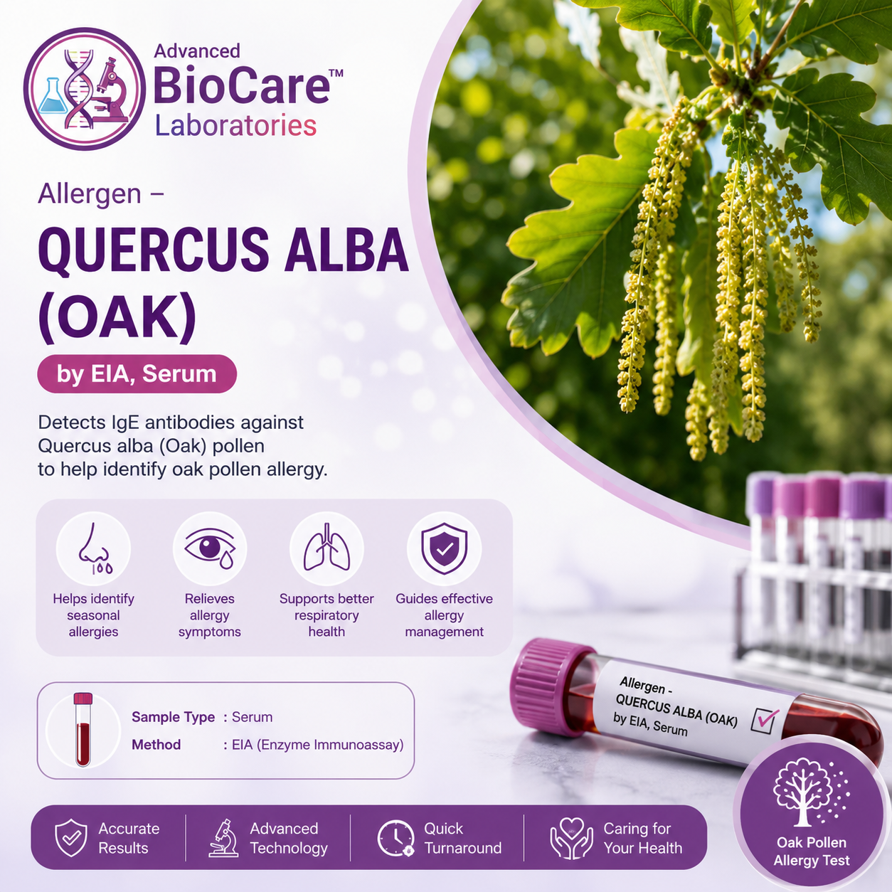 Allergen - QUERCUS ALBA (OAK) by EIA, Serum
