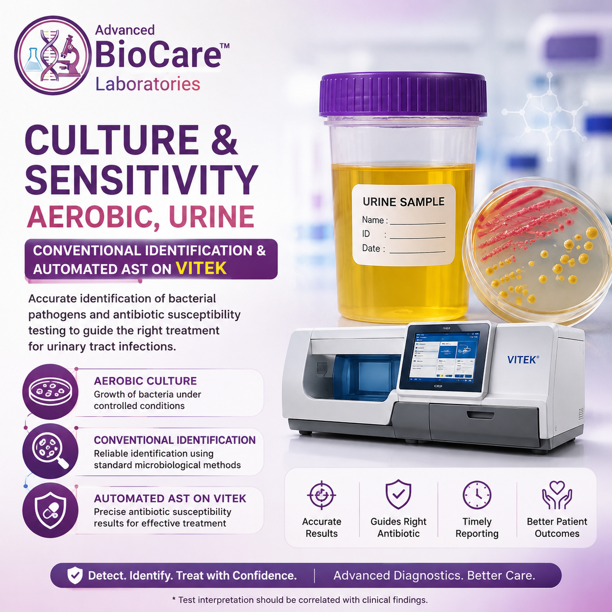 Culture & Sensitivity, Aerobic, Urine- Conventional Identification & Automated AST on Vitek