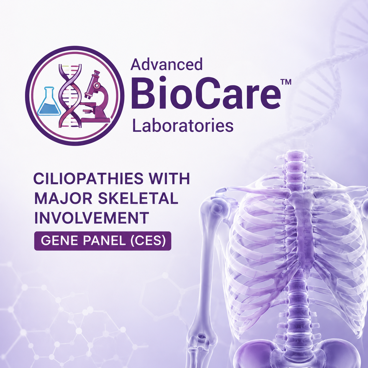 Ciliopathies with major skeletal involvement gene panel (CES)