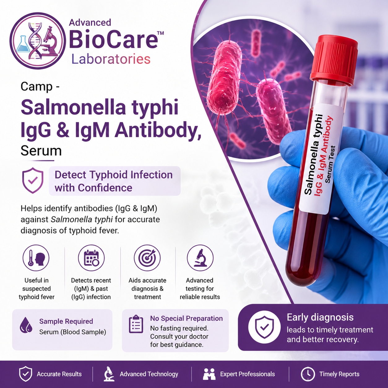 Salmonella typhi IgG & IgM antibody, Serum