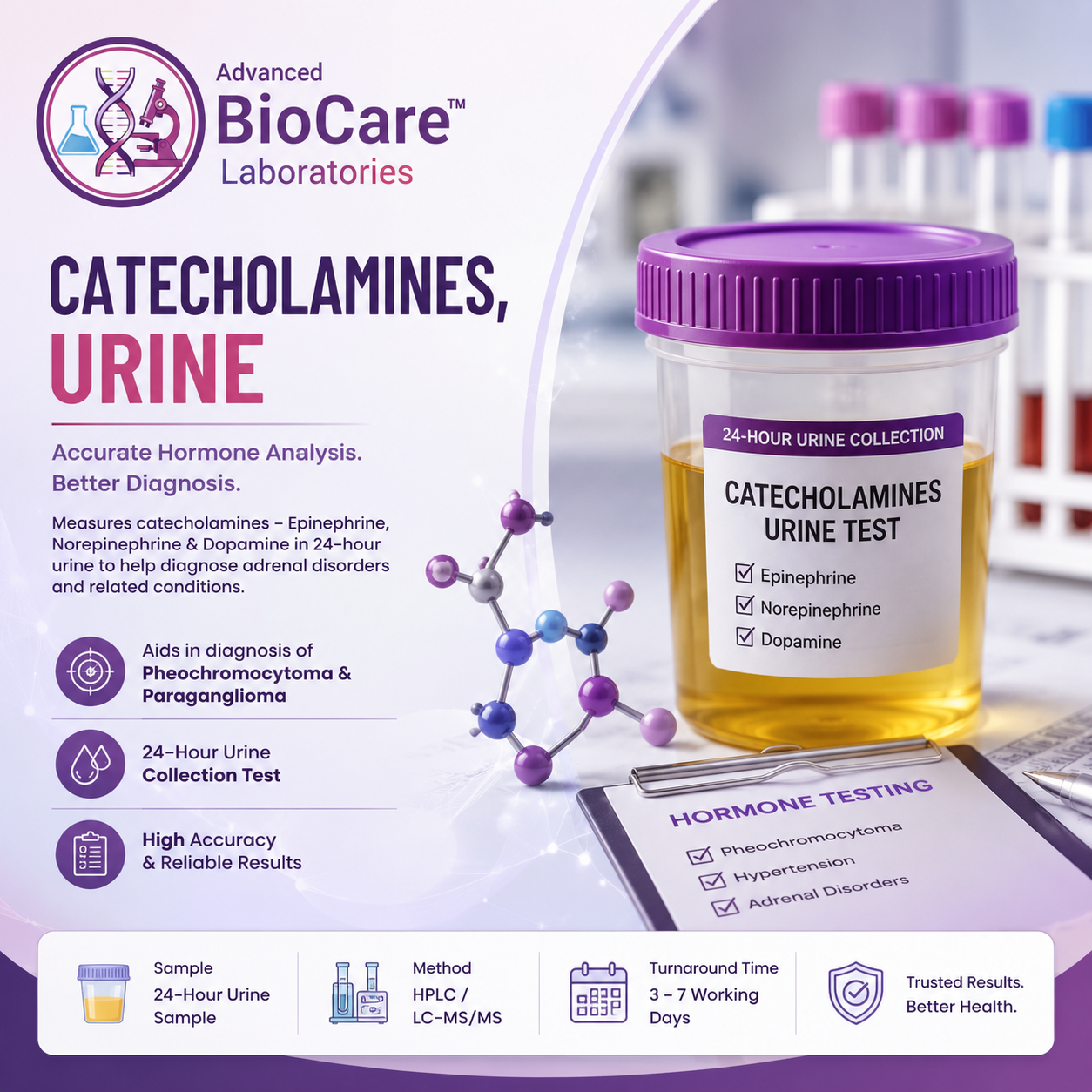 Catecholamines, Urine