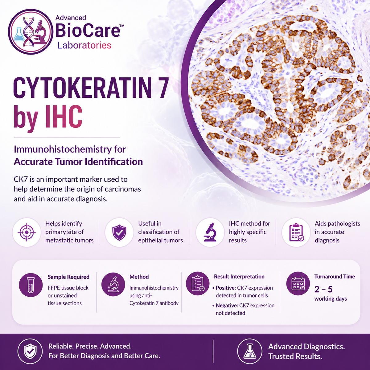 CYTOKERATIN 7 by IHC