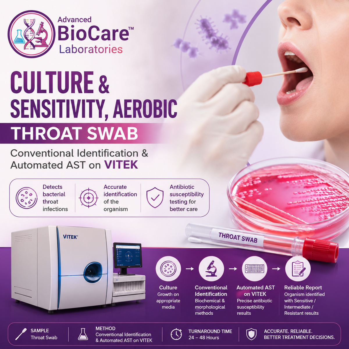 Culture & Sensitivity, Aerobic, Throat swab- Conventional Identification & Automated AST on Vitek