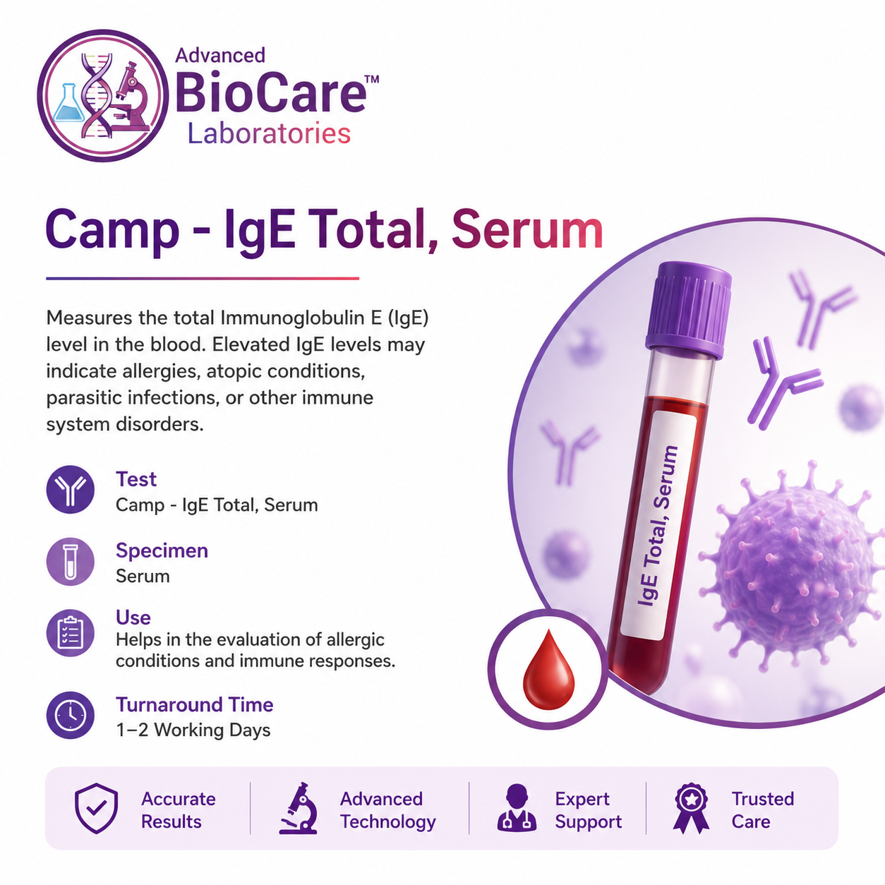 IgE Total, Serum