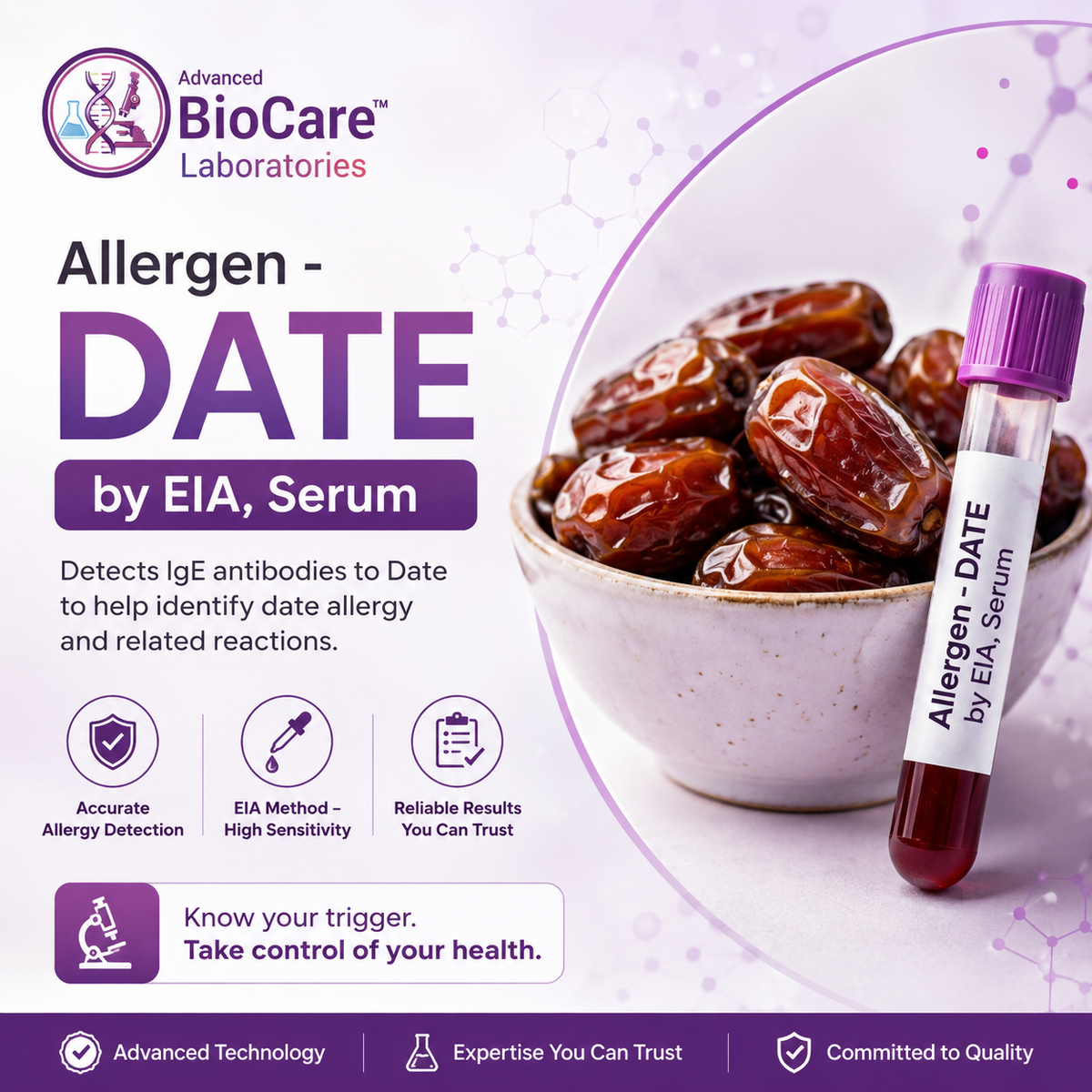 Allergen - DATE by EIA, Serum