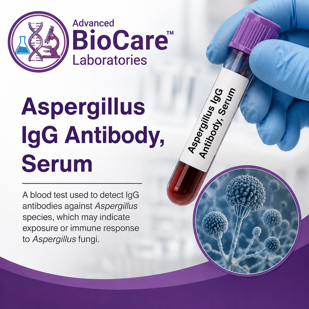 Allergen - Aspergillus IgG Antibody, Serum