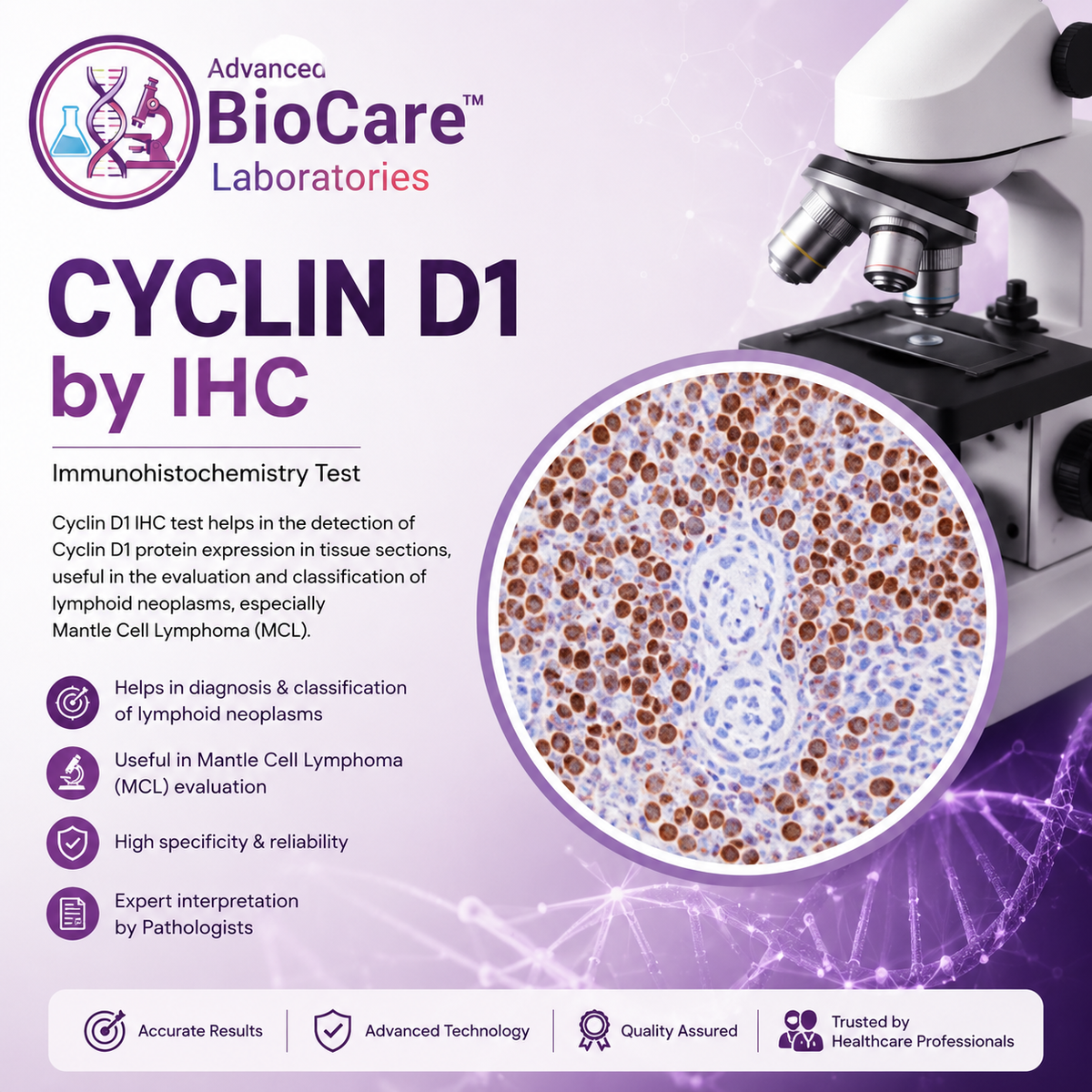 CYCLIN D1 by IHC