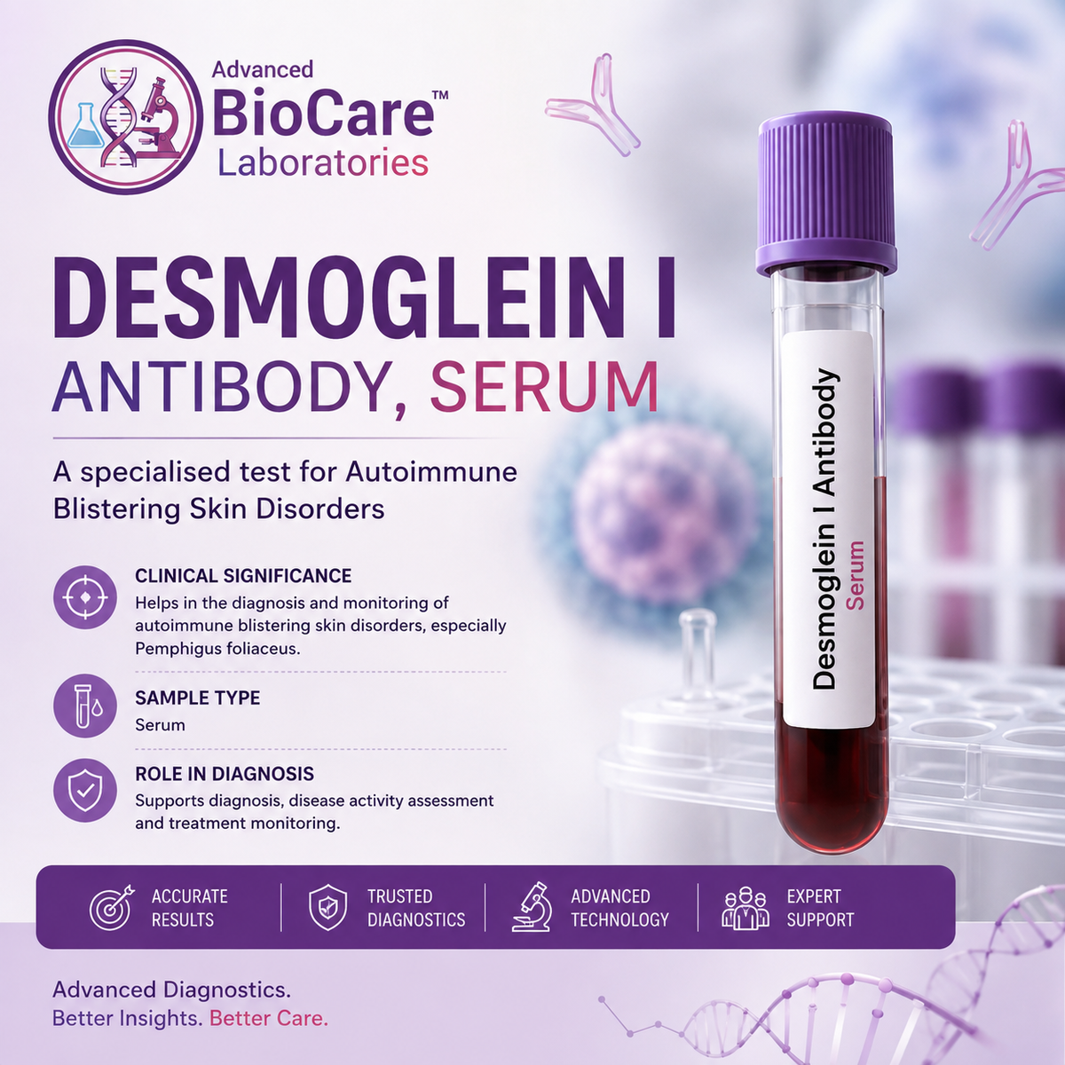 Desmoglein I Antibody, Serum