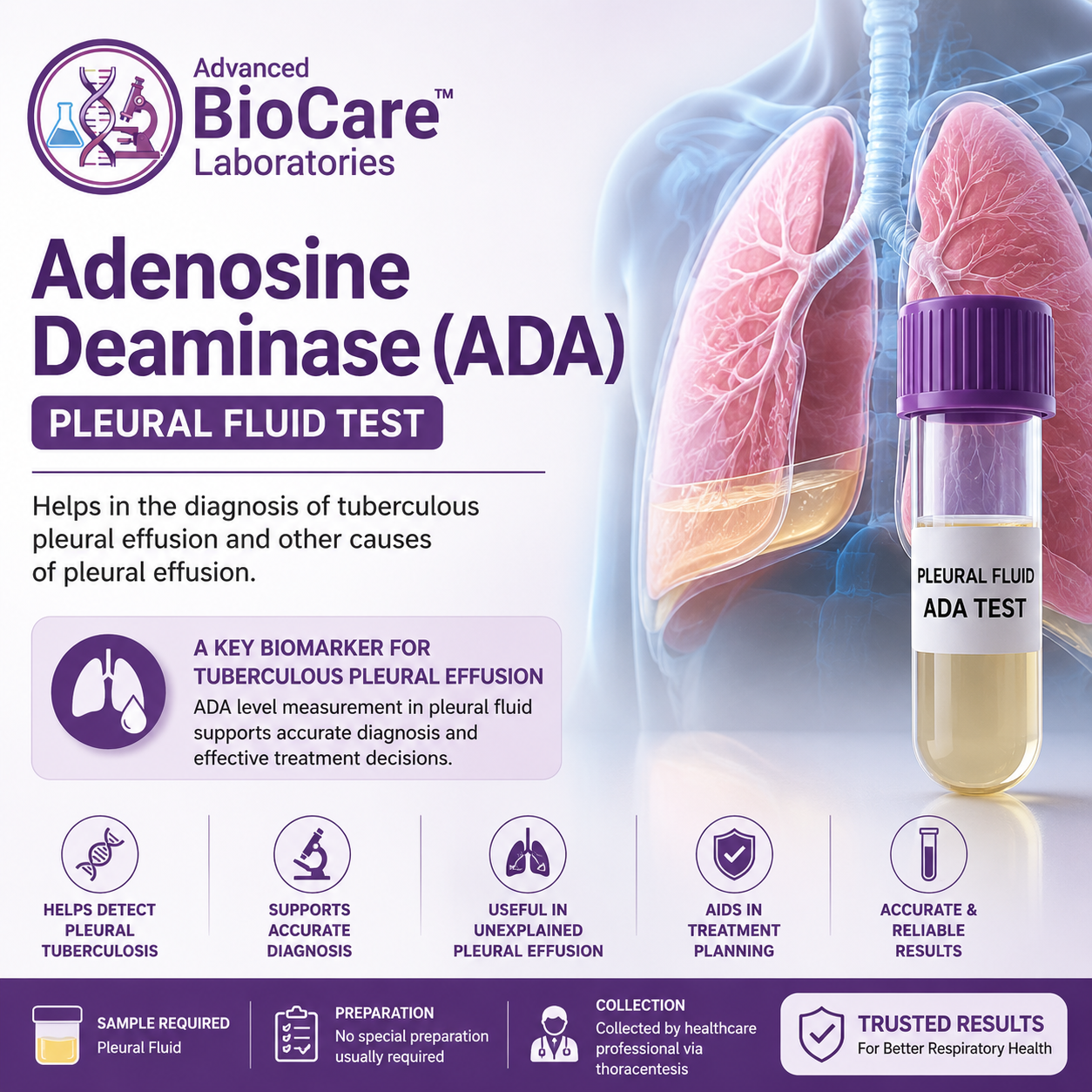 Adenosine Deaminase(ADA), Pleural Fluid