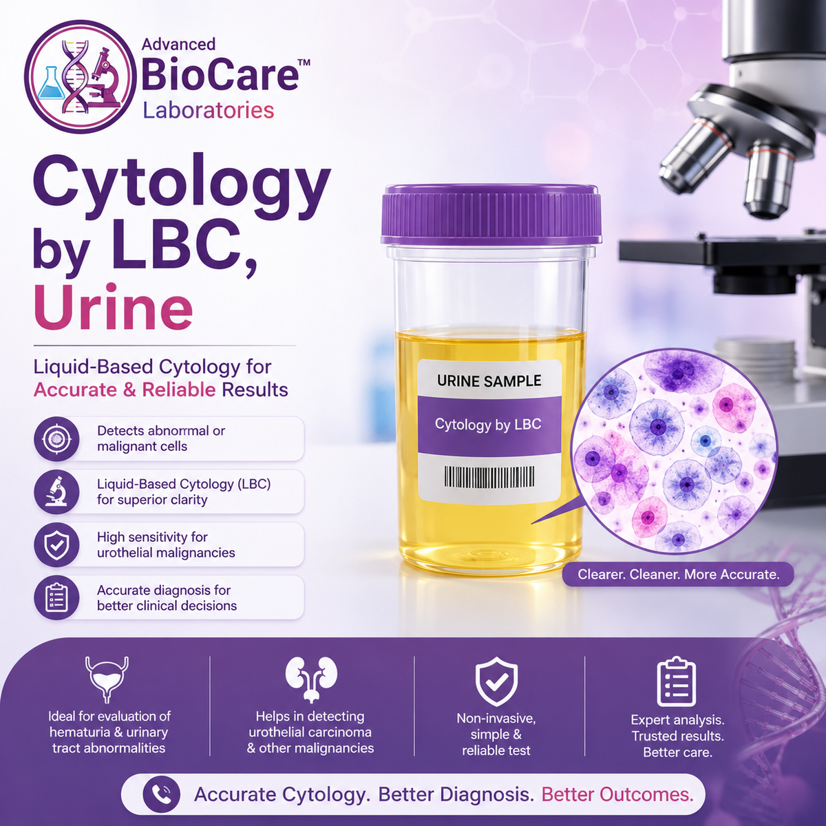 Cytology by LBC, Urine