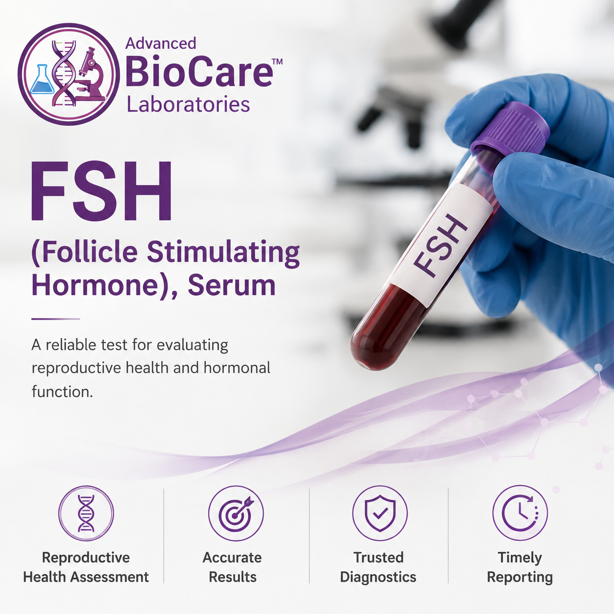 FSH (Follicle Stimulating Hormone), Serum