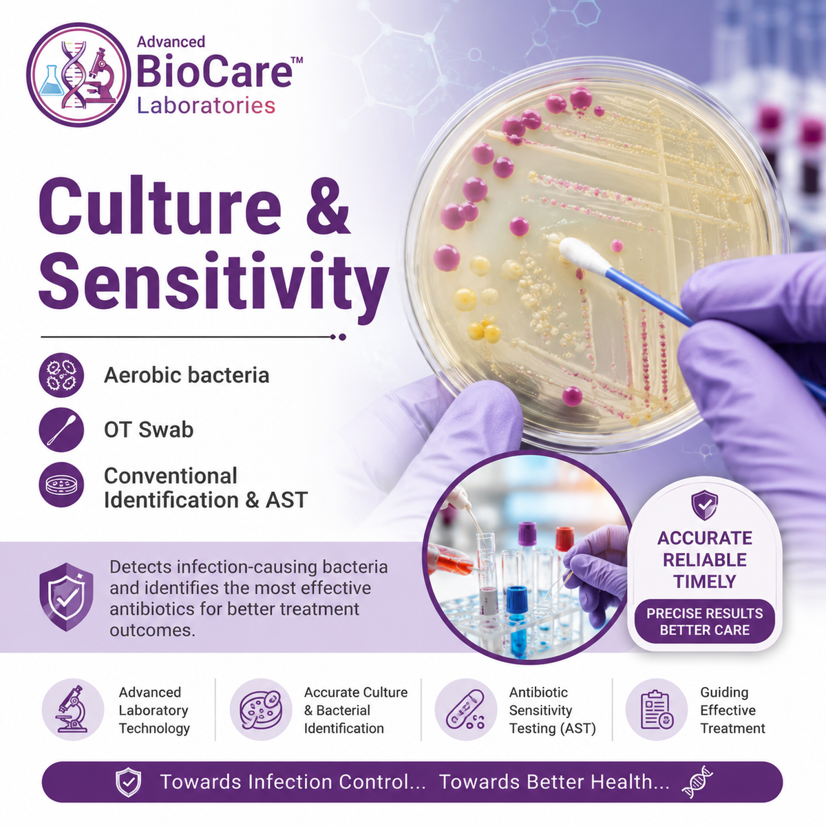 Culture & Sensitivity, Aerobic bacteria, OT Swab, Conventional Identification & AST