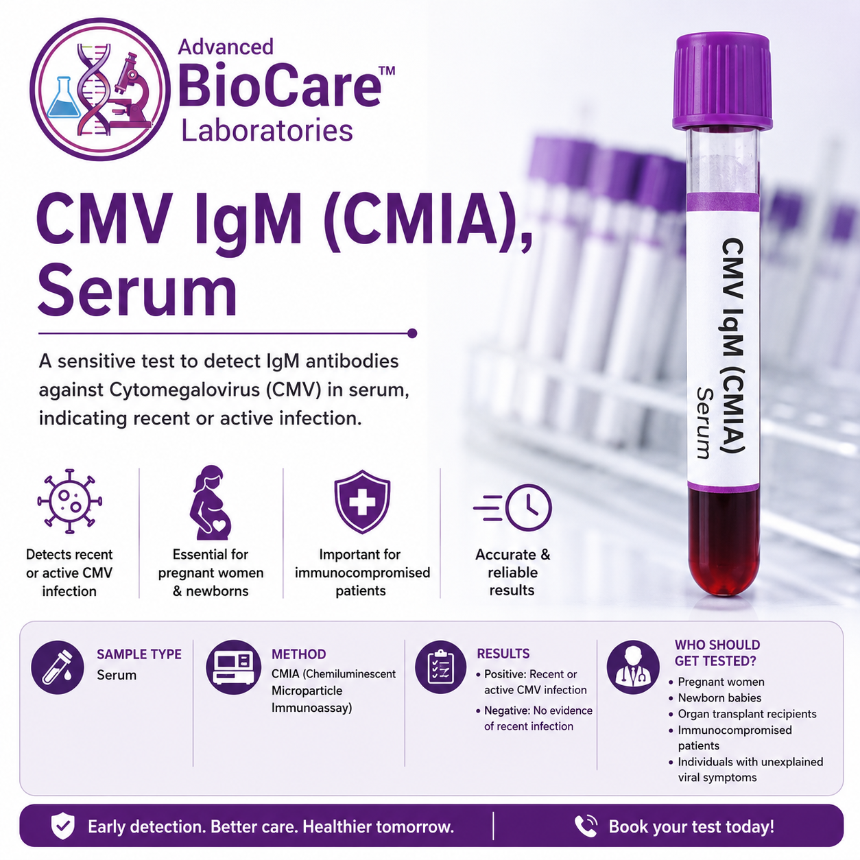 CMV IgM (CMIA), Serum