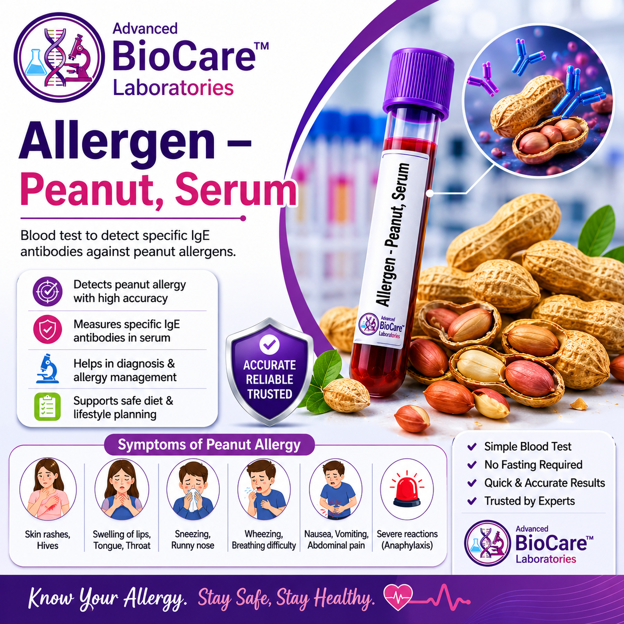 Allergen- Peanut, Serum