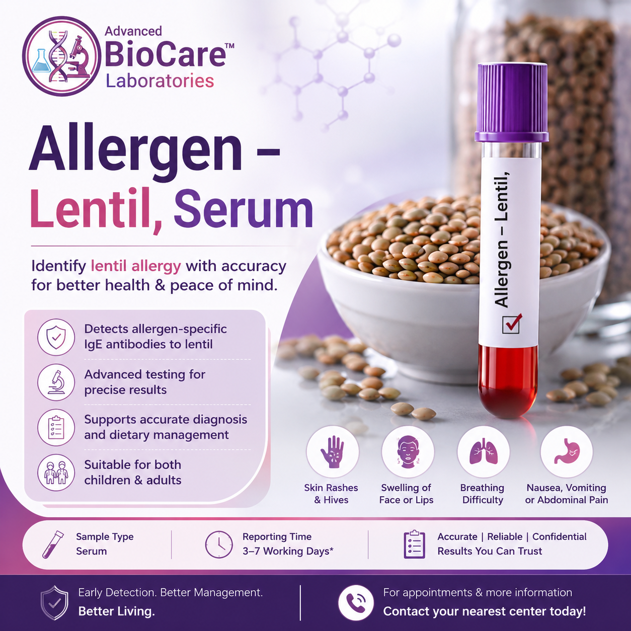 Allergen - Lentil, Serum
