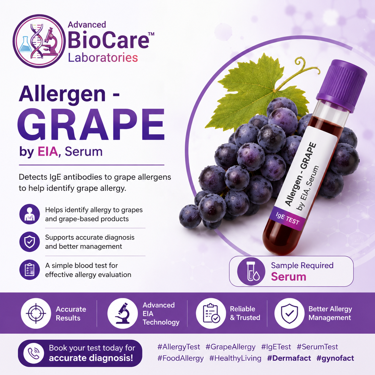 Allergen - GRAPE by EIA, Serum