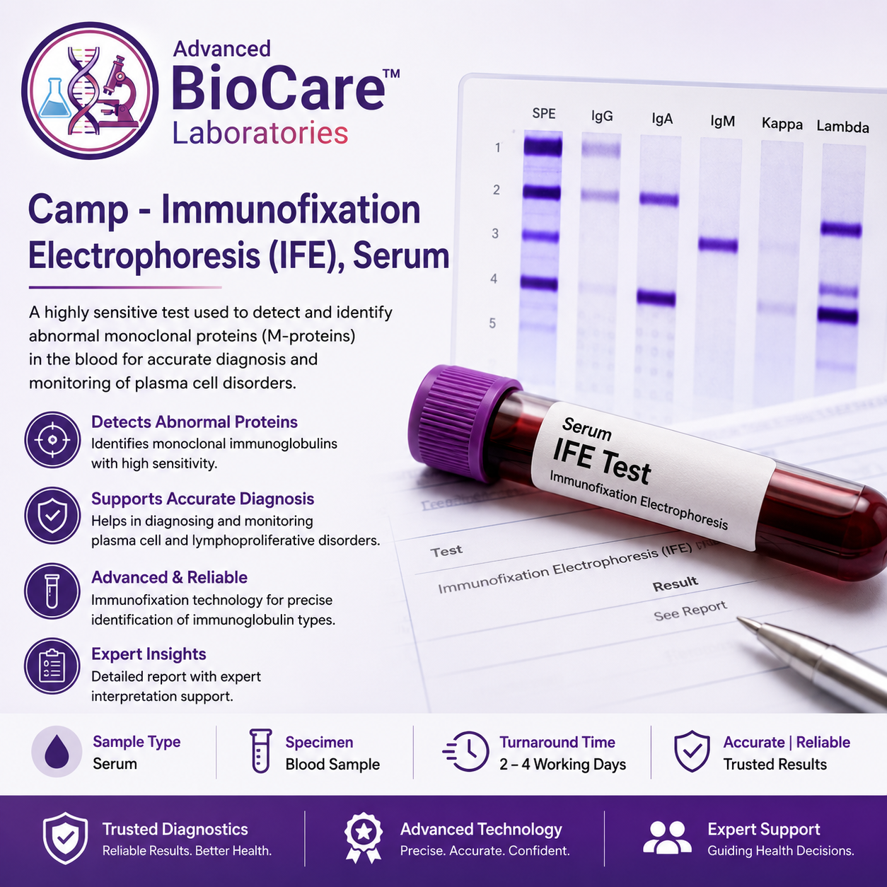 Immunofixation Electrophoresis, Serum