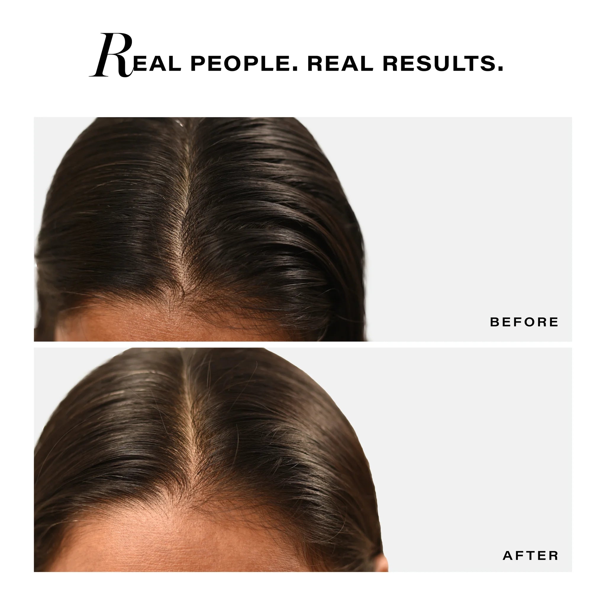 Sebosys Control Scalp Serum for 48hrs Sebum Control, 50ml