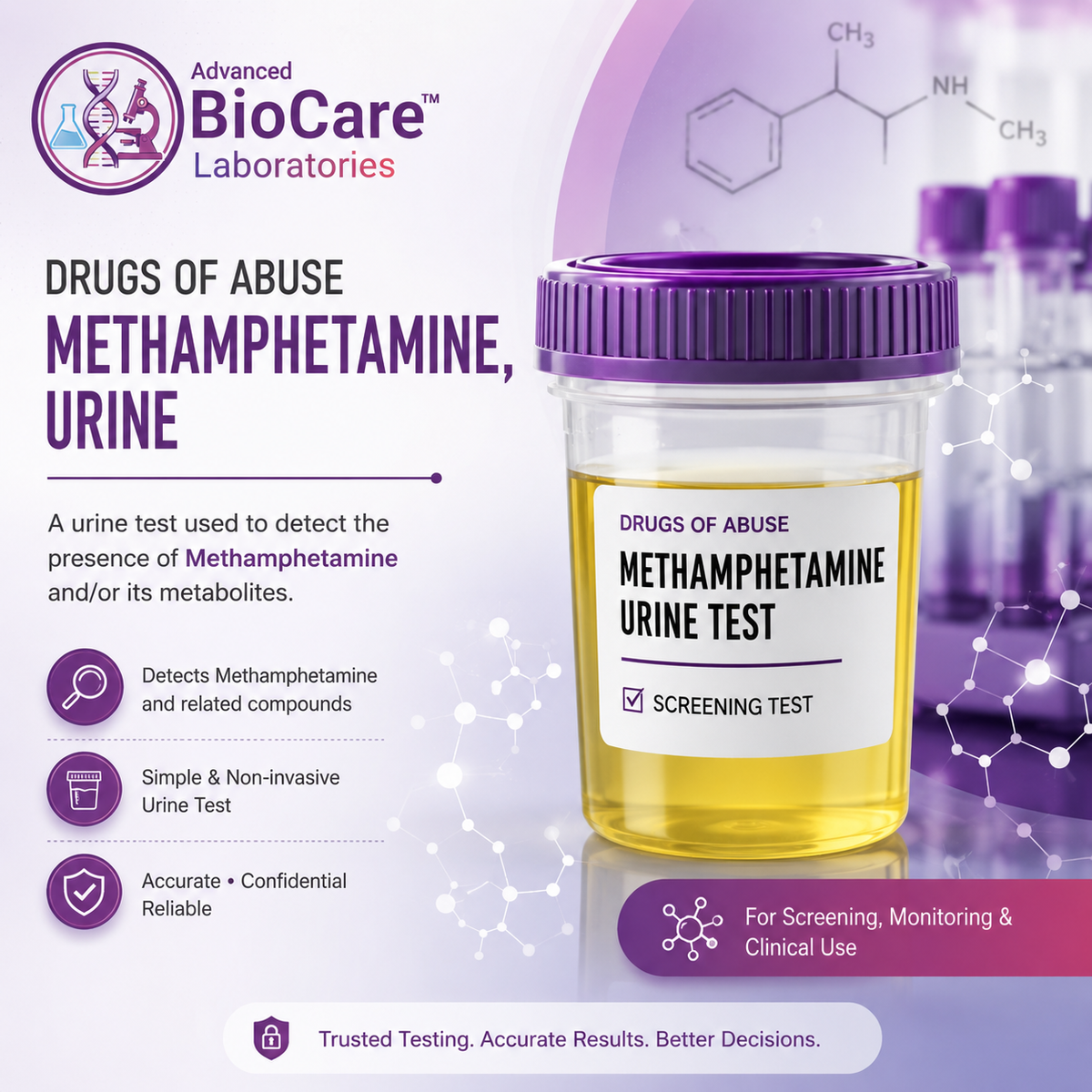 Drugs Of Abuse - Methamphetamine, Urine