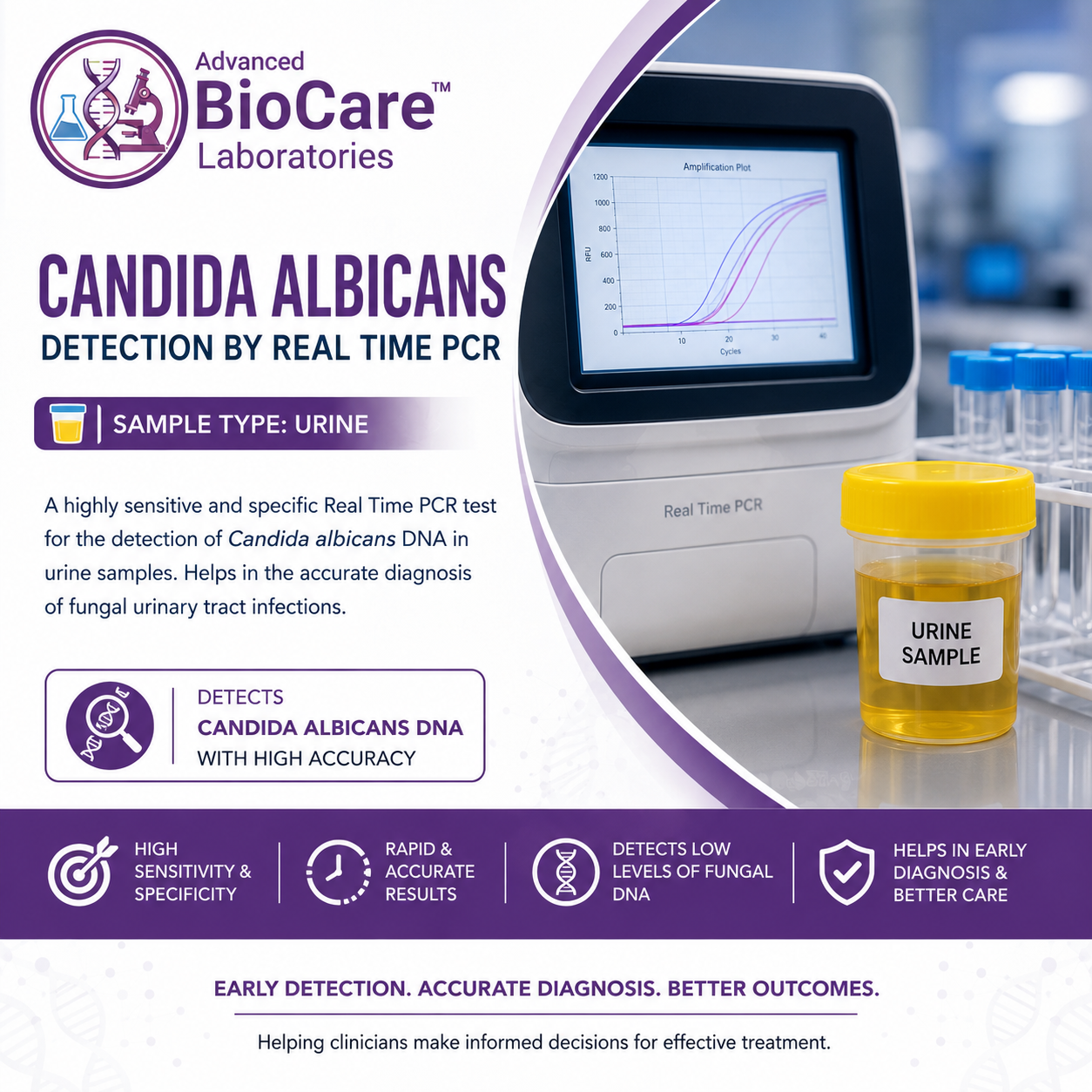 Candida Albicans Detection by Real Time PCR, Urine
