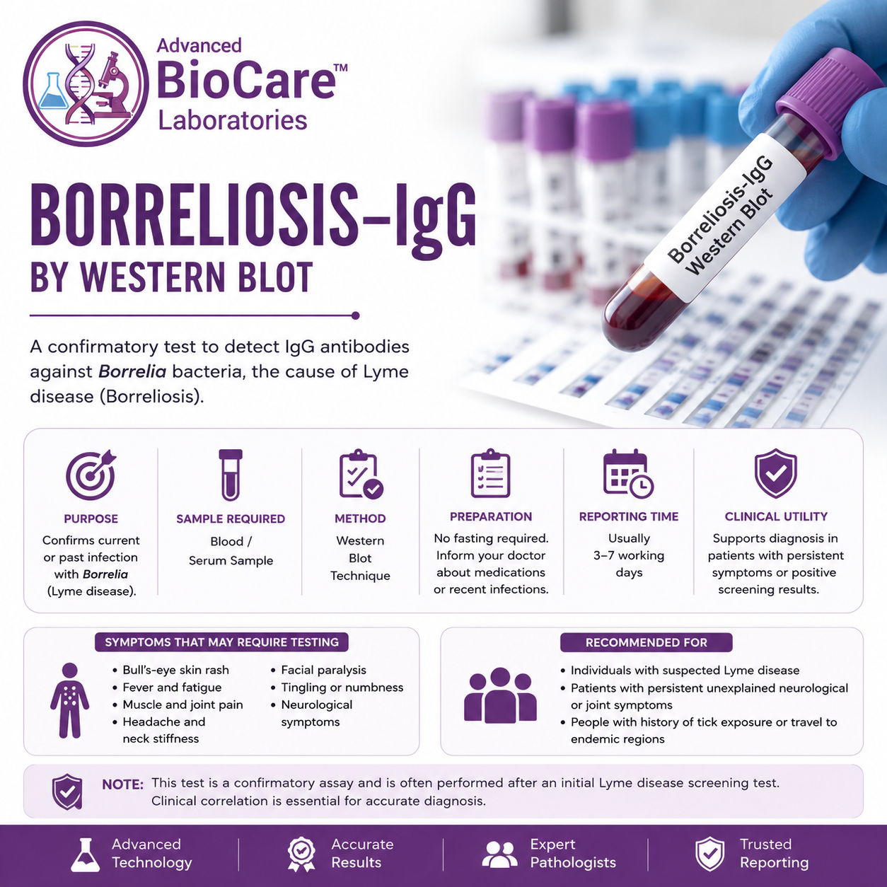 Borreliosis-IgG by Western Blot