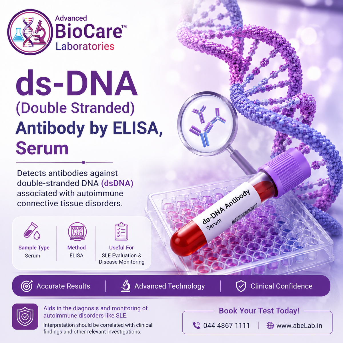 ds-DNA (Double stranded) - Antibody by ELISA, Serum