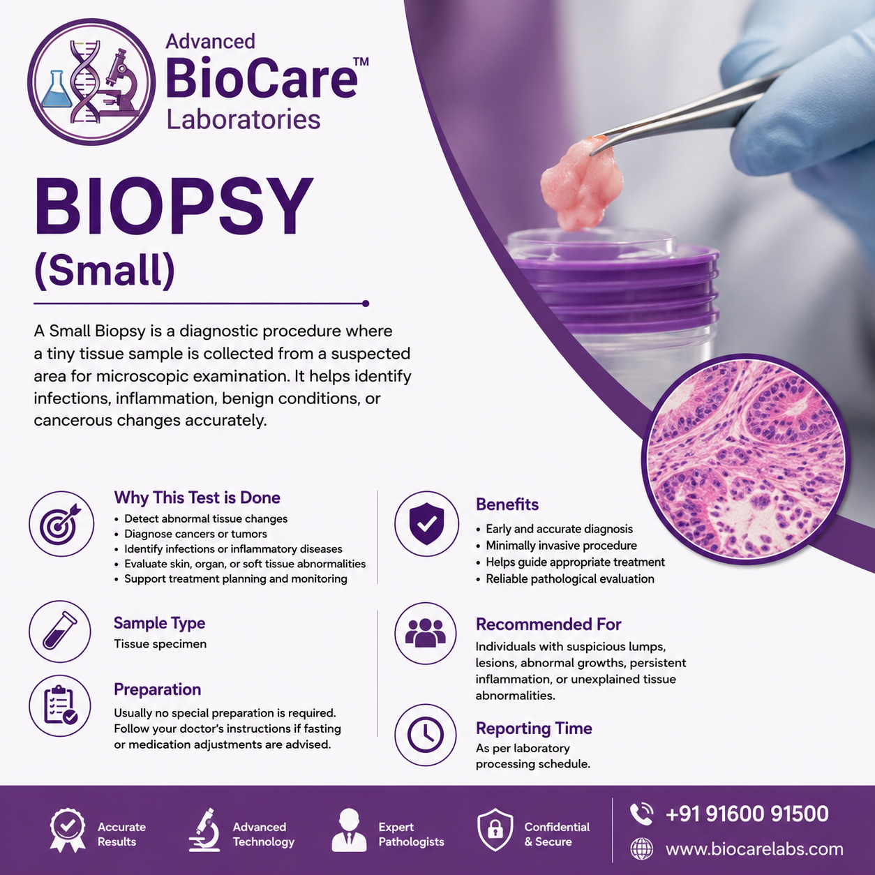 BIOPSY (Small)