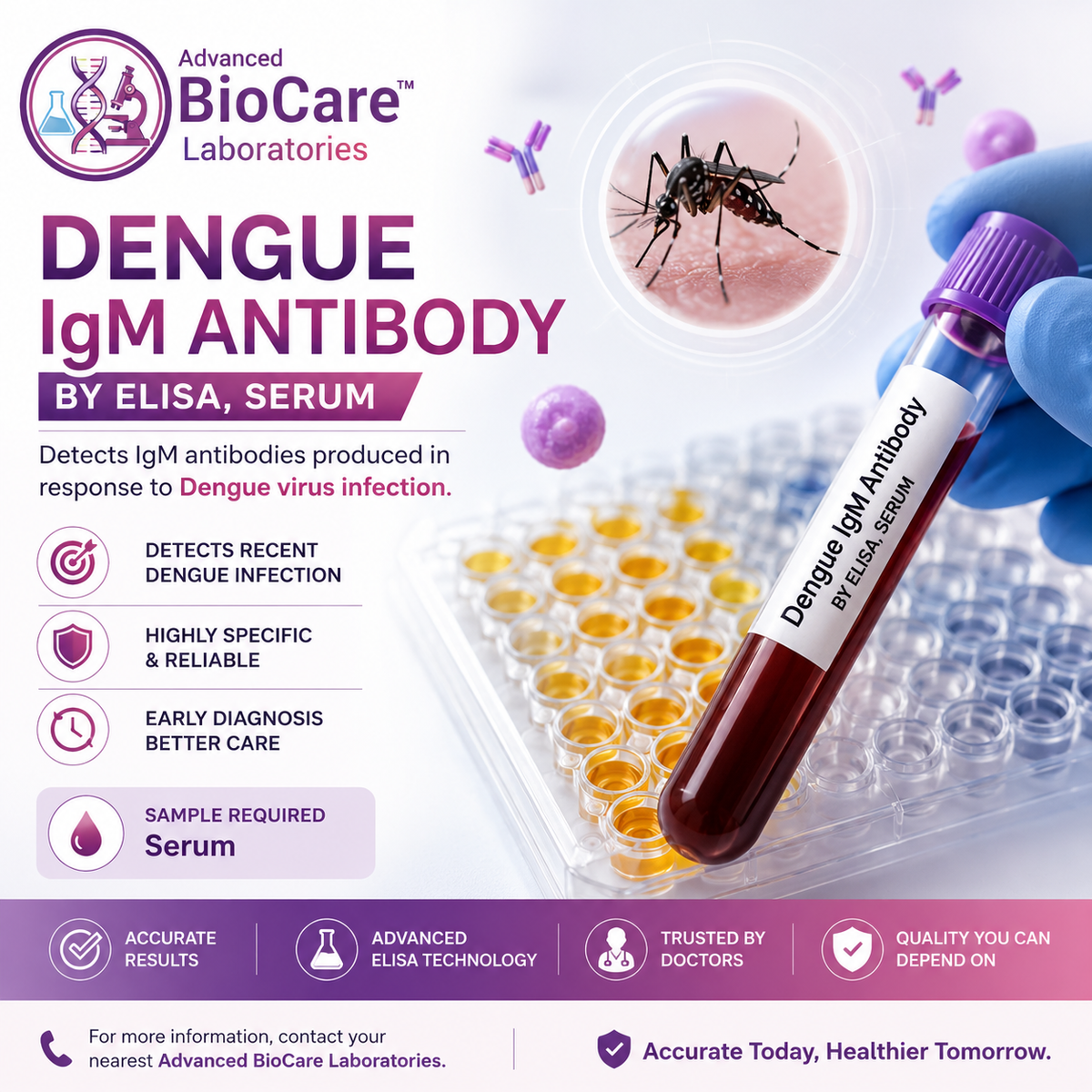 Dengue IgM Antibody by ELISA, Serum