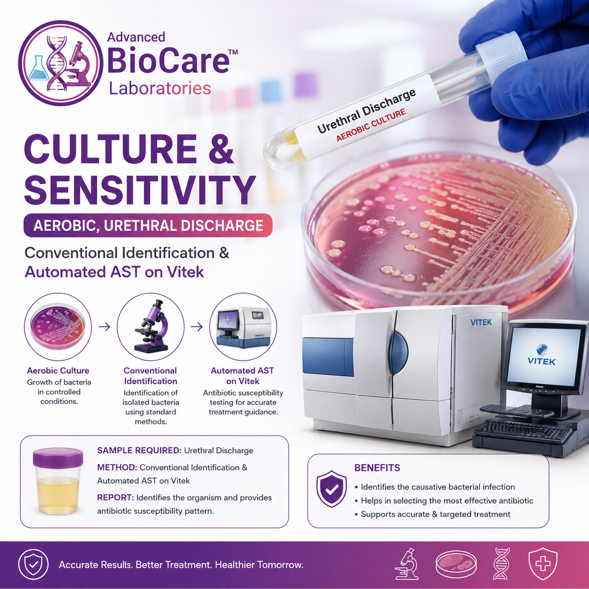 Culture & Sensitivity, Aerobic, Urethral Discharge- Conventional Identification & Automated AST on Vitek