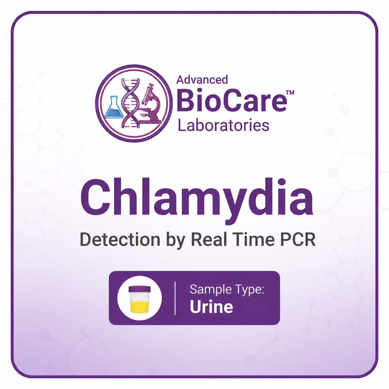 Chlamydia Detection by Real Time PCR, Urine