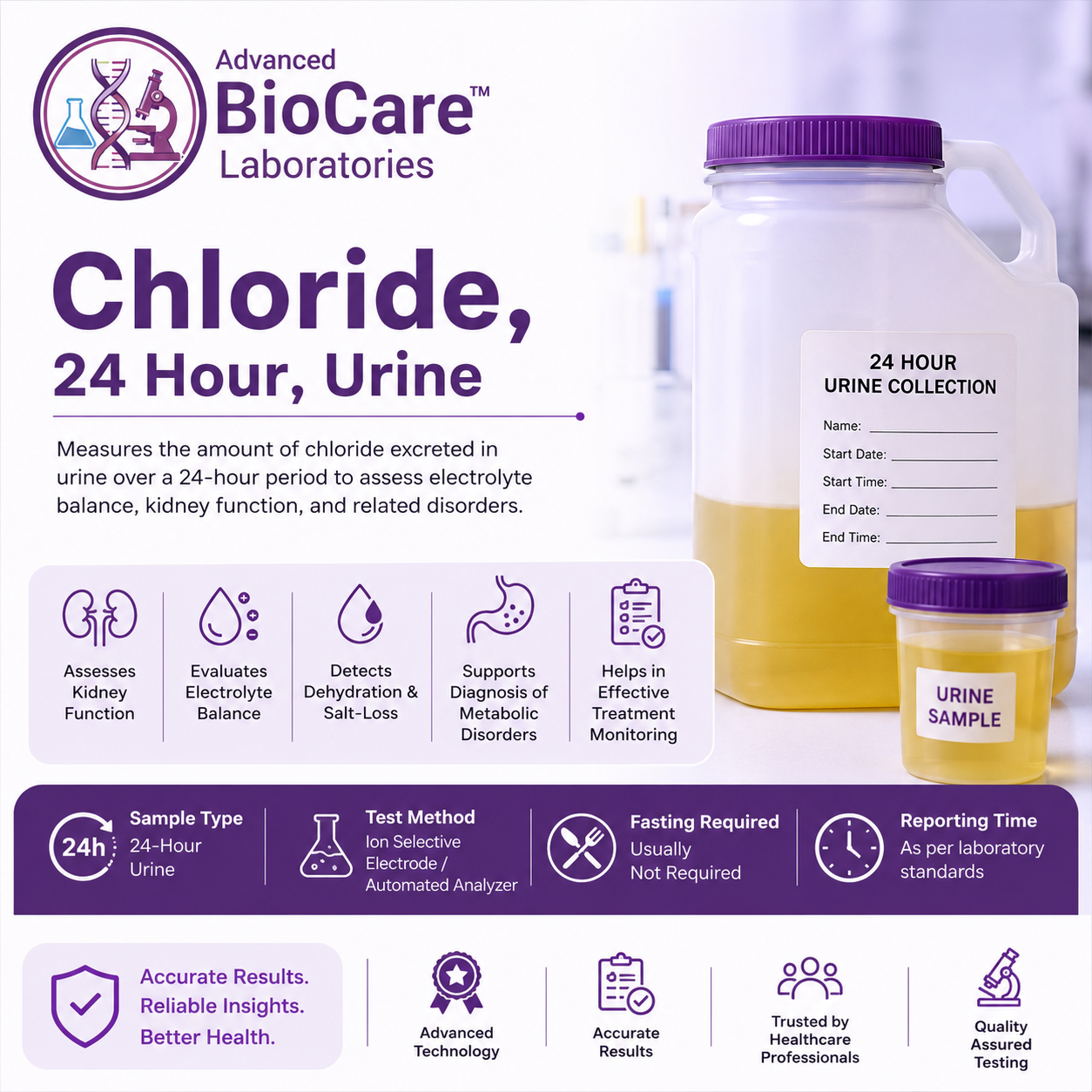 Chloride,24 Hour,Urine