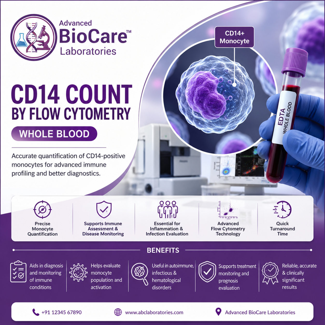 CD14 Count by Flowcytometry...