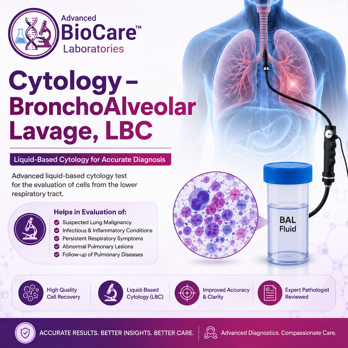 Cytology - BronchoAlveolar Lavage, LBC