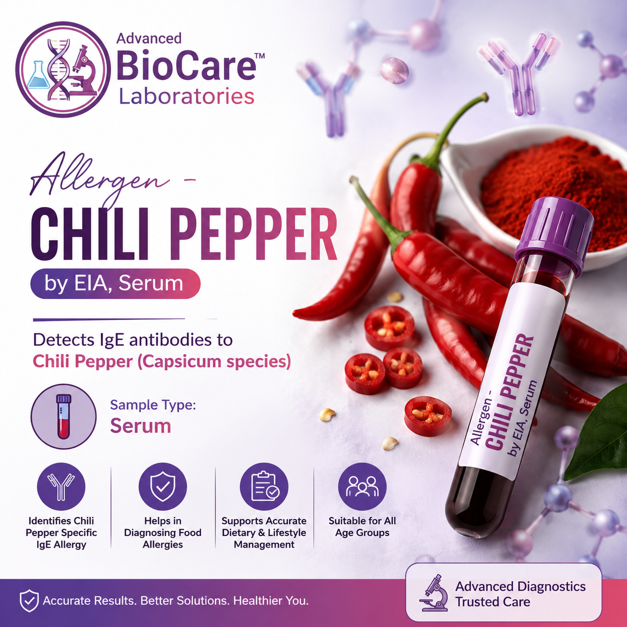 Allergen - CHILI PEPPER by EIA, Serum