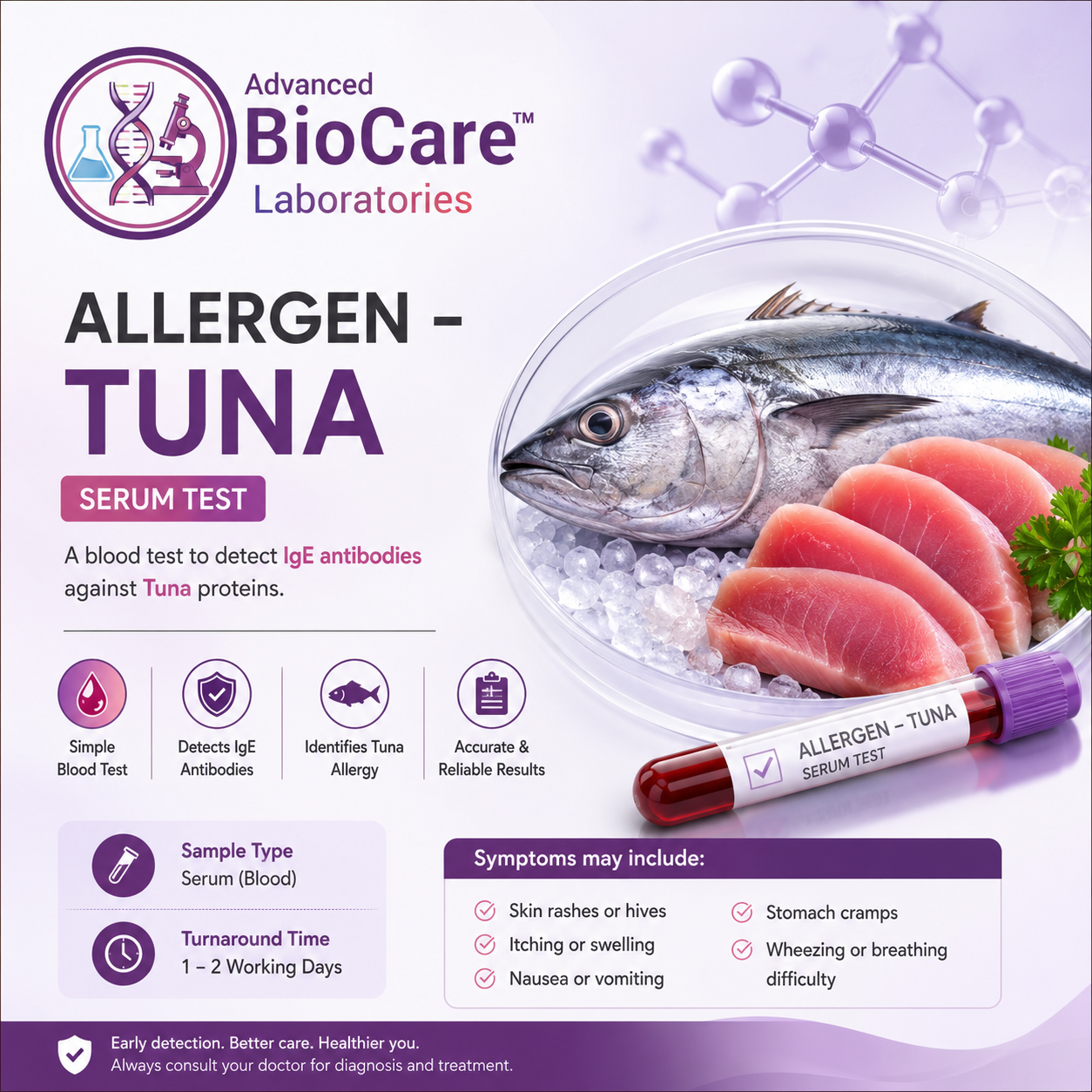 Allergen - Tuna, Serum