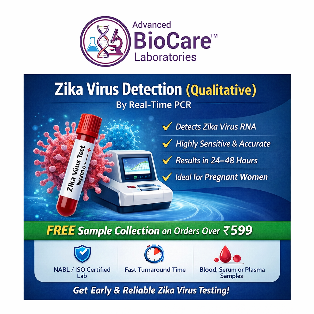 Zika Virus Detection (Qualitative)  by Real TIme PCR