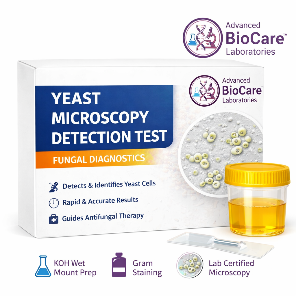 Yeast Microscopy Detection