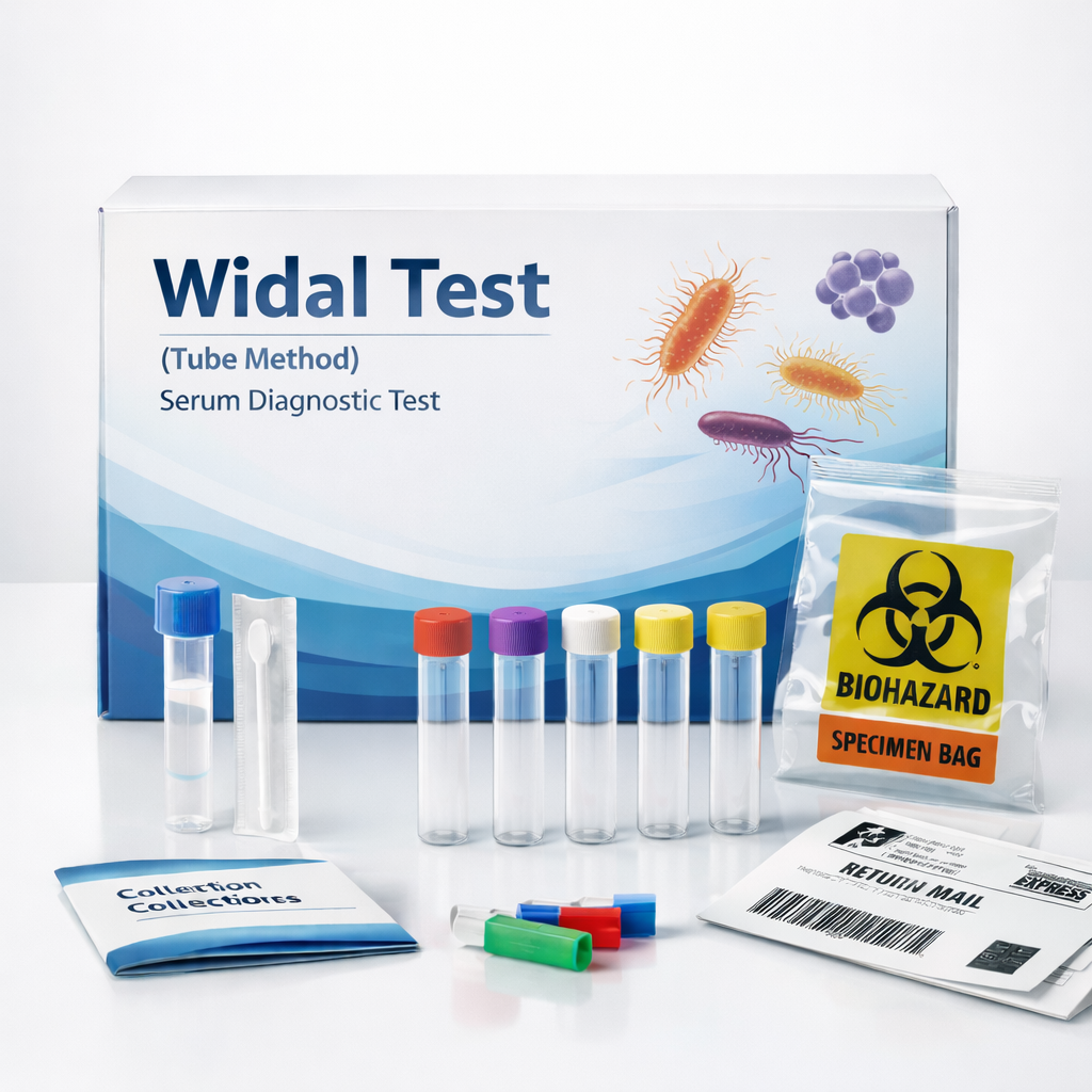 Widal test (Tube Method), Serum