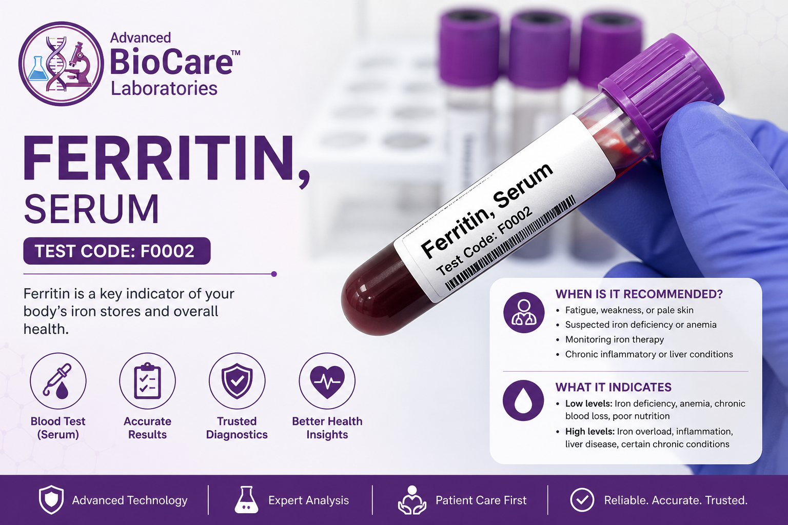 Ferritin, Serum