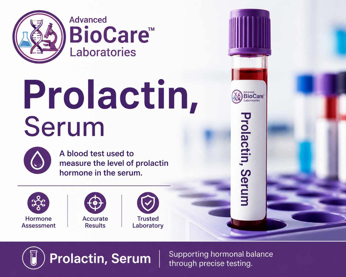 Prolactin, Serum
