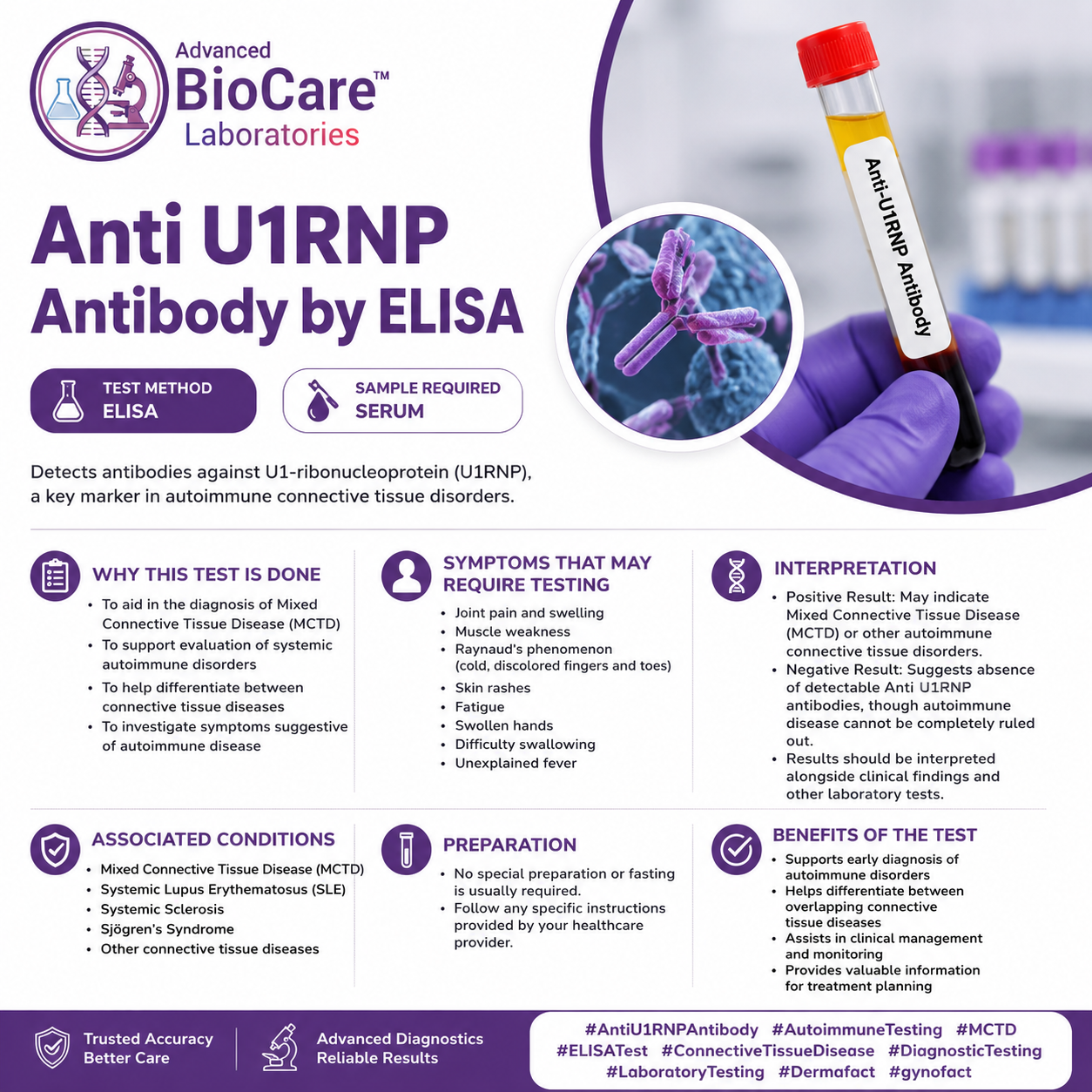 Anti U1RNP Antibody by ELISA, Serum