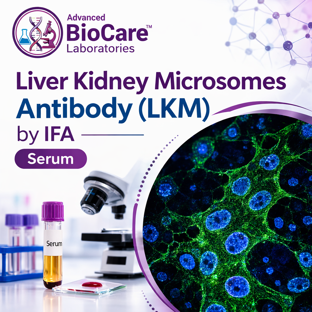 Liver kidney Microsomes Antibody (LKM) by IFA, Serum