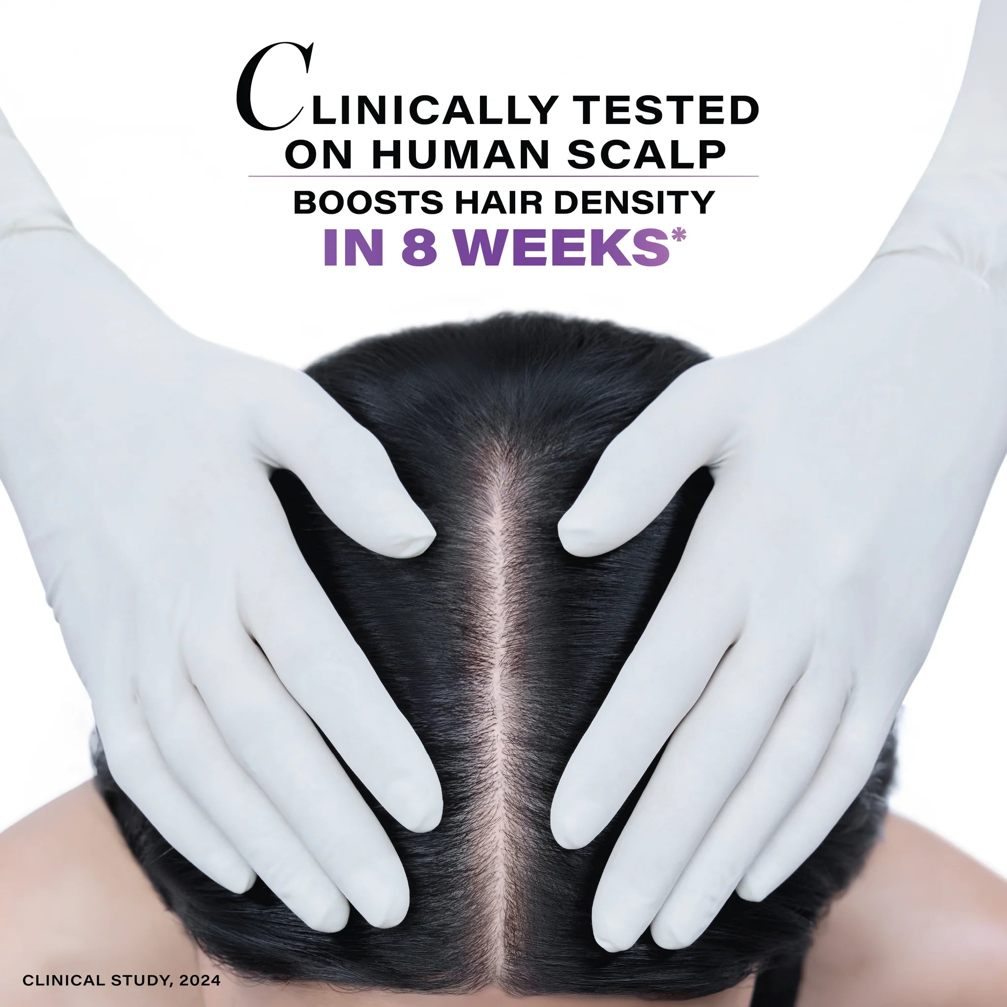 Follicle Revive Scalp Serum for Hair Growth (50ml) | 4% Dynagen + Zinc + Niacinamid